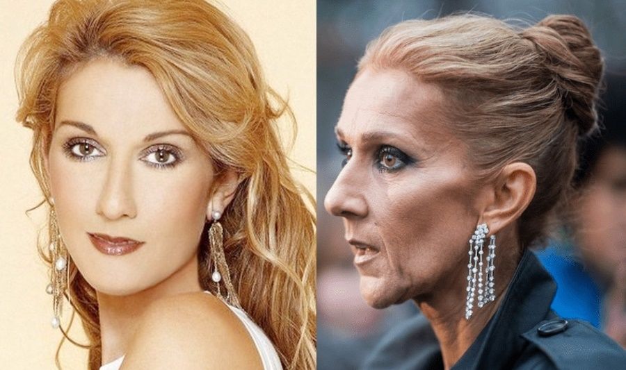 Celine dion discount enferma 2023