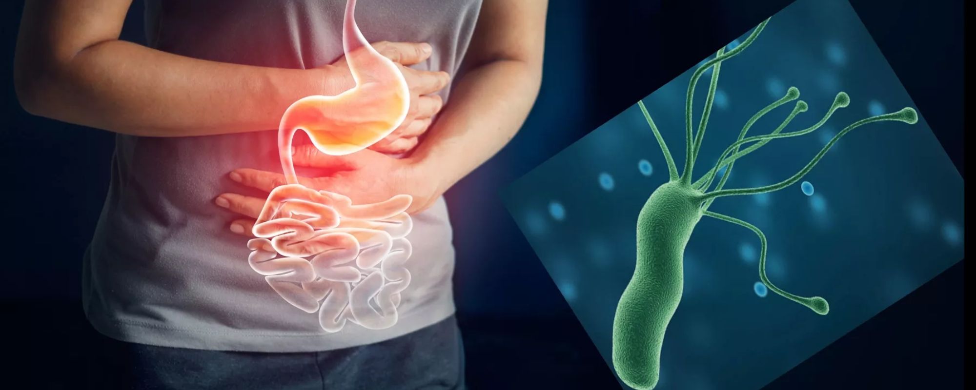 ¿Sabe Usted Qué Es La Helicobacter Pylori? Esta Bacteria Ocasiona ...